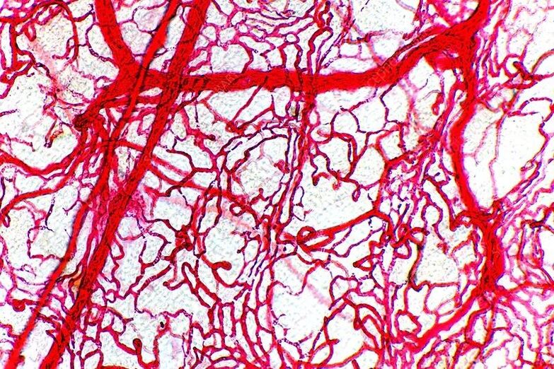 damage to blood vessels