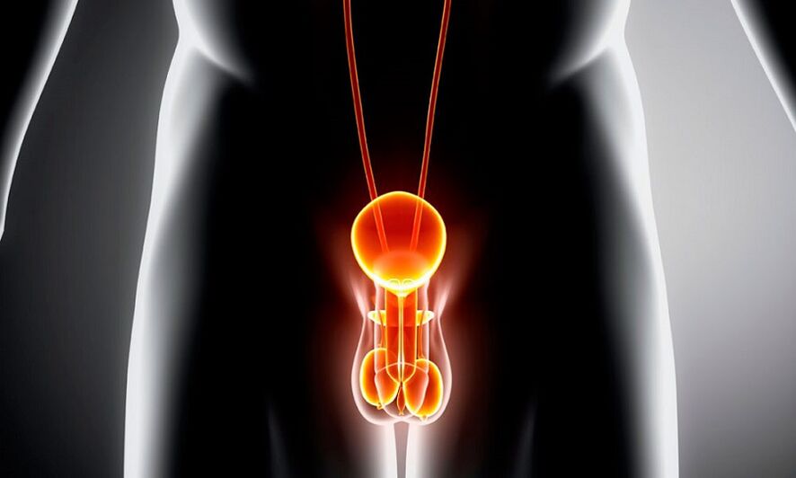 inflamed genitourinary system for prostatitis
